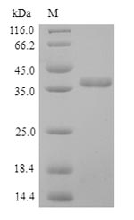 Human SFTPD protein