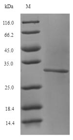 Human GLS protein