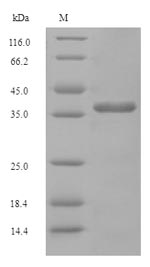 Fungi DDP1 protein