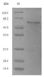 E. coli purD protein