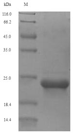 Human AGTR2 protein