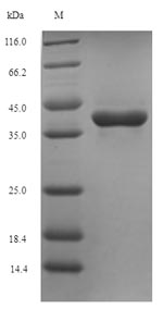 Bacterial tmk protein
