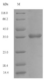 Human FCRL6 protein