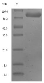 Human GLS2 protein