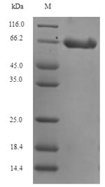 Human DCX protein