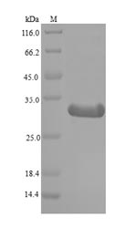 Mouse Sap130 protein