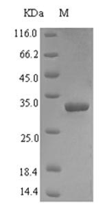 Human VPS13A protein