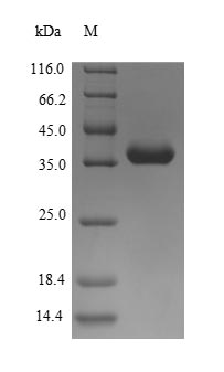 Cat Fel d 4 protein