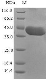Viral Nucleoprotein protein