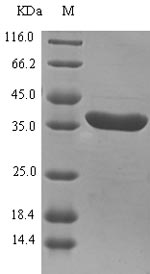 Rat SDH1 protein