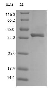 E. coli ompA protein