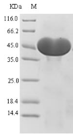 Human ACLY protein