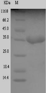 E. coli tir protein