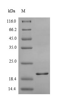 Human CXCR2 protein