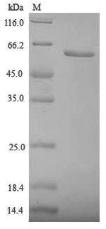 Human ZP3 protein