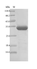 Plant BETVIA protein