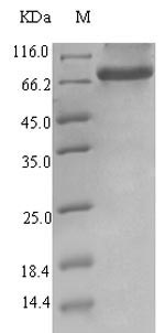 Human ERVK-6 protein