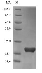 Human TREM2 protein