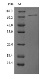 Human PPP1R15A protein