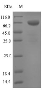 Mouse Tph1 protein