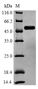 Human GSK3B protein