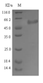 Bacterial sdrE protein