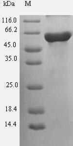 Human GNAS protein