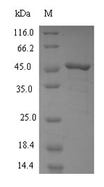 Human FDFT1 protein