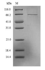 Viral Nucleoprotein protein