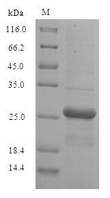 Human GUK1 protein