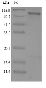 Human SIRT1 protein