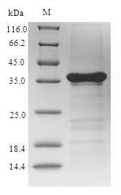 Animal Sarcoplasmic calcium binding protein protein