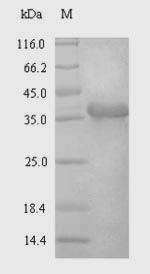 Human SDC4 protein