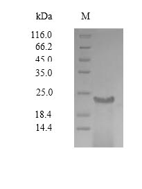 Viral Envelope glycoprotein protein