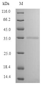Bovine MBL protein