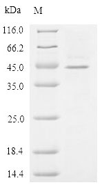 Human ZP3 protein