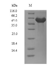 Human DYRK2 protein