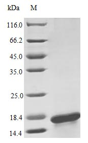 Human IL17F protein (Active)