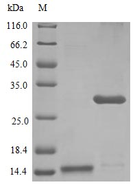 Human IL17 protein (Active)