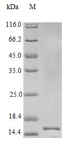 Human IL22 protein (Active)