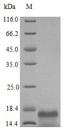 Human CSF1 protein (Active)