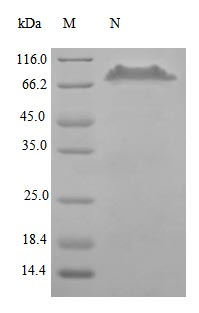 Human TR11B protein (Active)