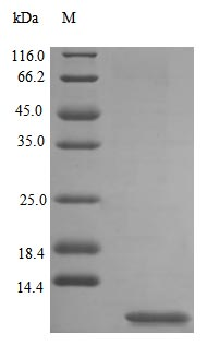 Rat UTER protein (Active)