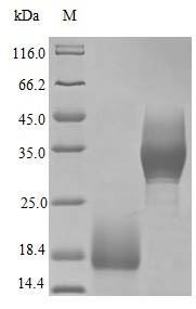 Human TFF3 protein (Active)
