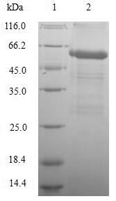 Human DLAT DLTA protein