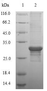 Human KCND1 protein