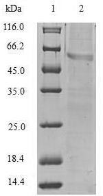 Human VIM protein