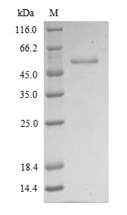 Human VIM protein