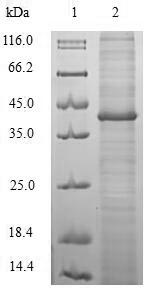 Bacterial Calprotectin protein