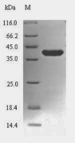 Bacterial lon protein